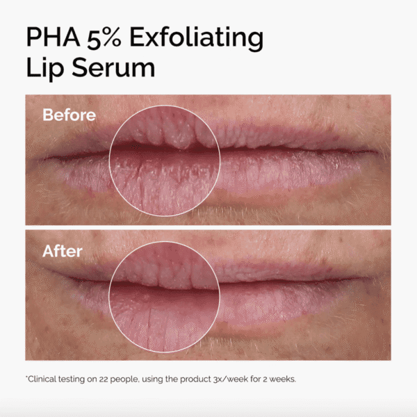 PHA 5% Exfoliating Lip Serum - Image 3