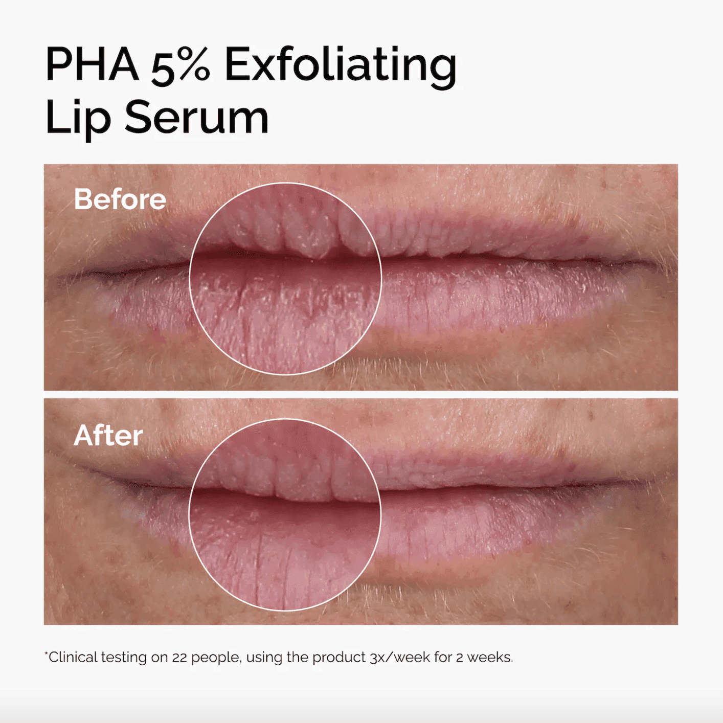 PHA 5% Exfoliating Lip Serum - Image 3