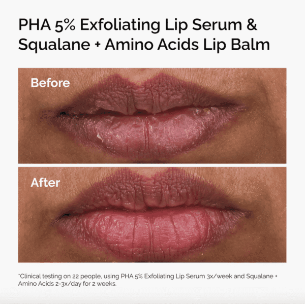 PHA 5% Exfoliating Lip Serum - Image 4