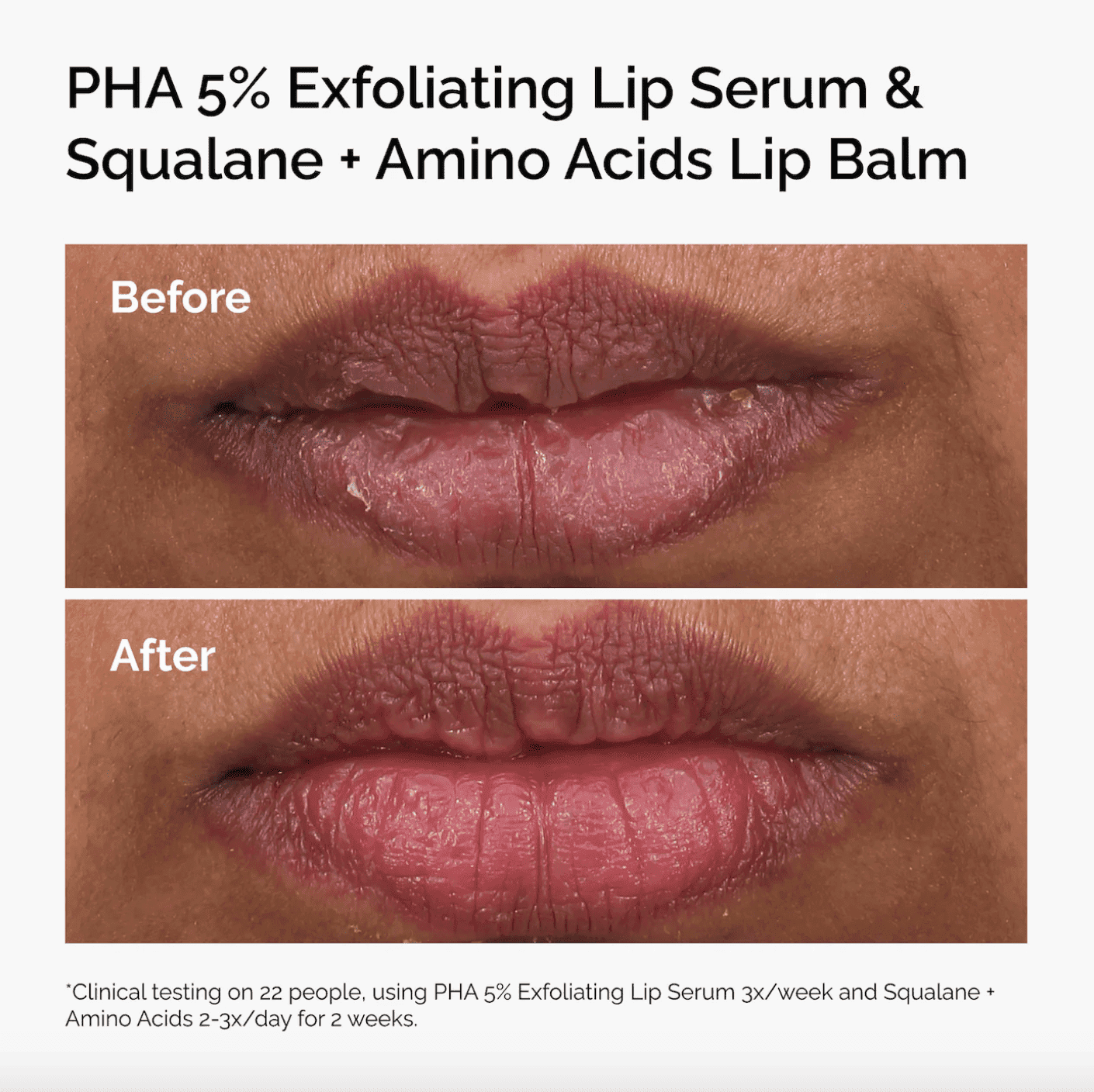 PHA 5% Exfoliating Lip Serum - Image 4